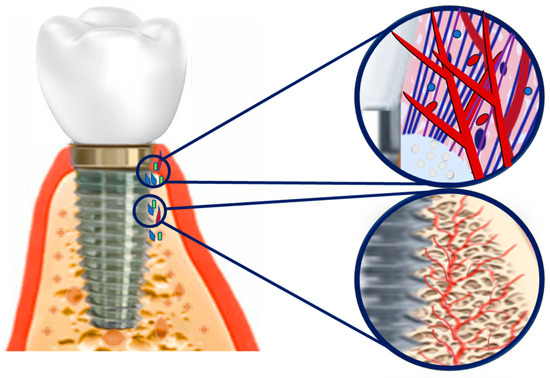 خواص ضد باکتریایی با انودایزینگ
